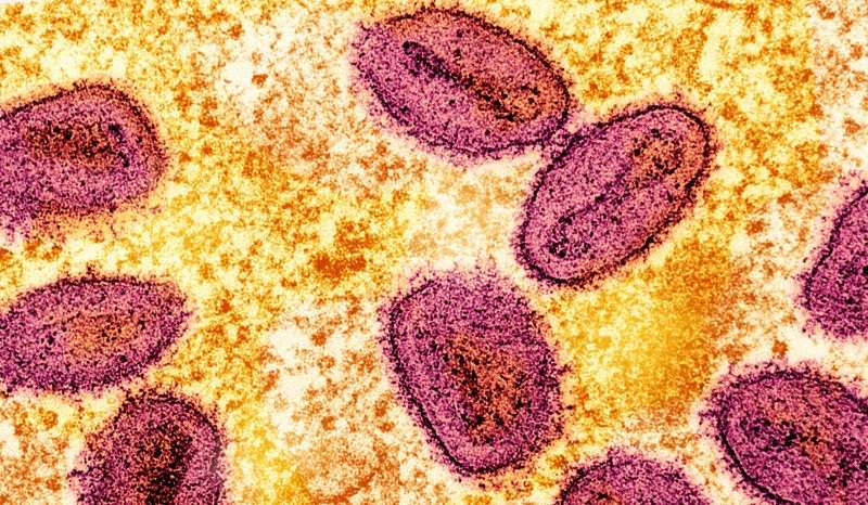 Colorized transmission electron micrograph of mpox virus particles captured at the NIAID Integrated Research Facility in Fort Detrick