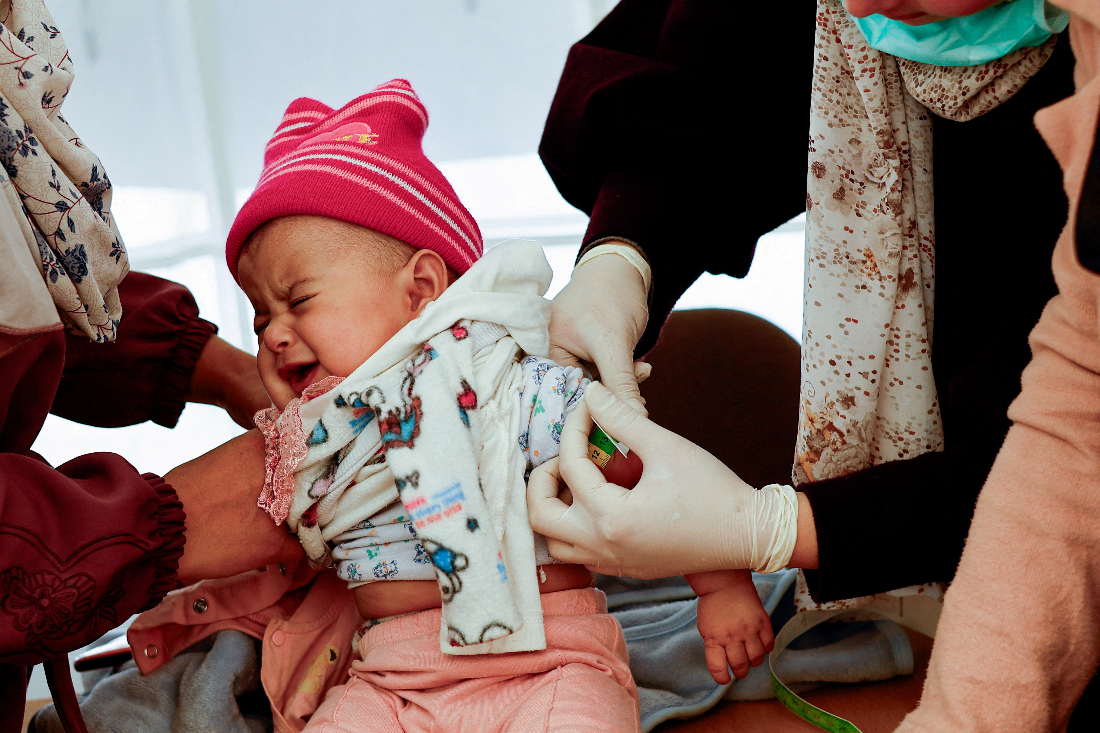 Palestinian children are checked for malnutrition, in Rafah, in the southern Gaza Strip