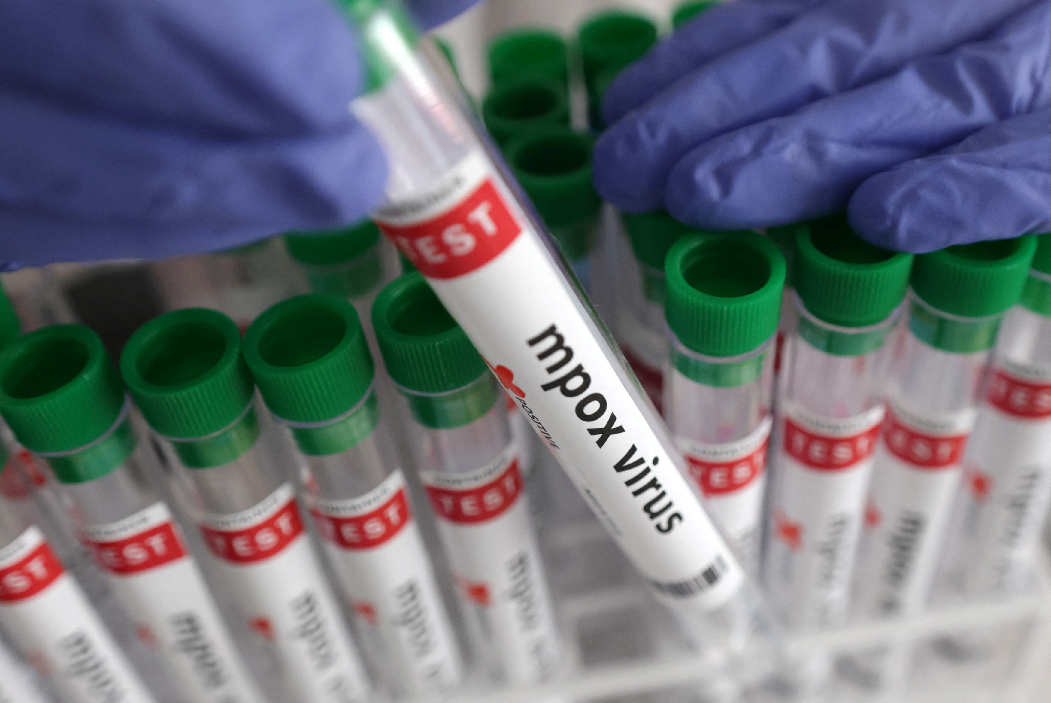 Illustration shows test tubes with "Mpox virus positive" label