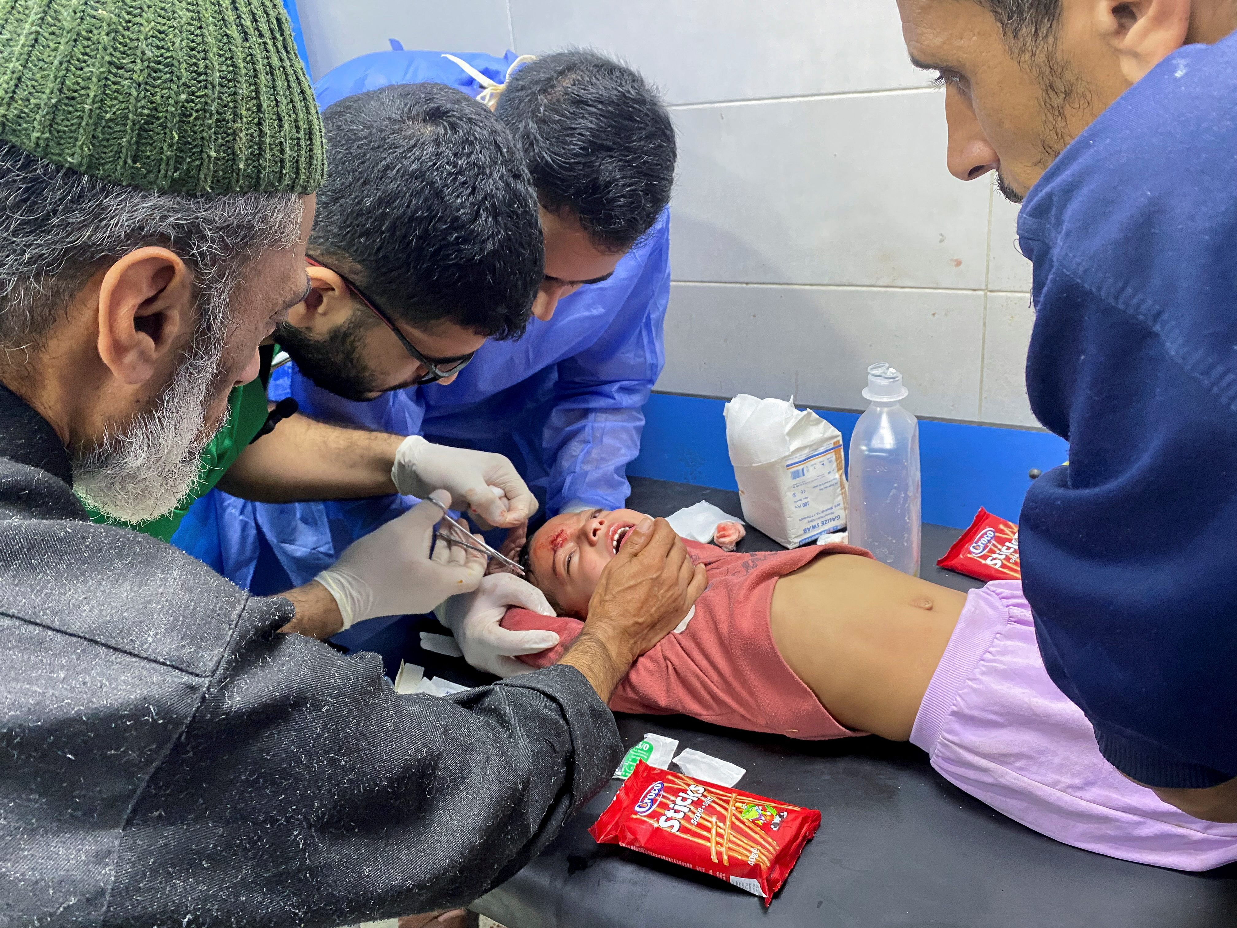 Palestinian girl Orheen Al-Dayah, who was injured on her forehead in an Israeli strike, has her wounds stitched without anaesthesia, at Al Shifa hospital in Gaza City
