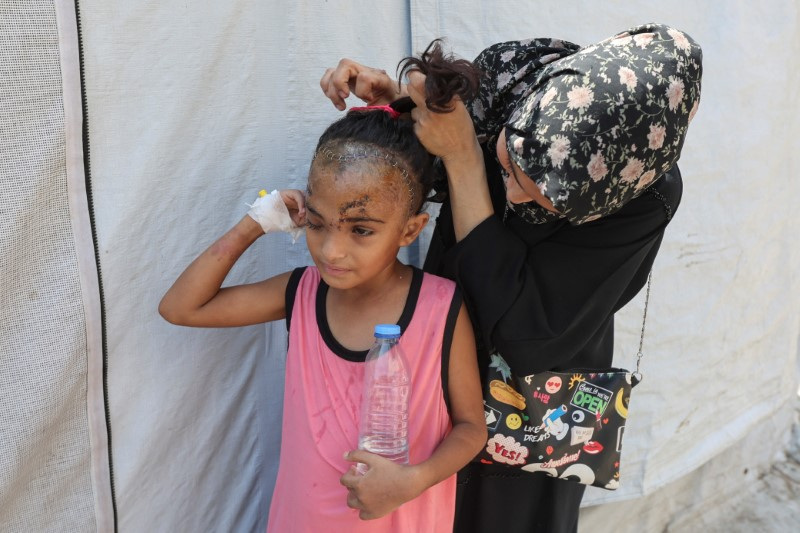 Gaza girl injured in her head in an Israeli strike battles hardship amid war