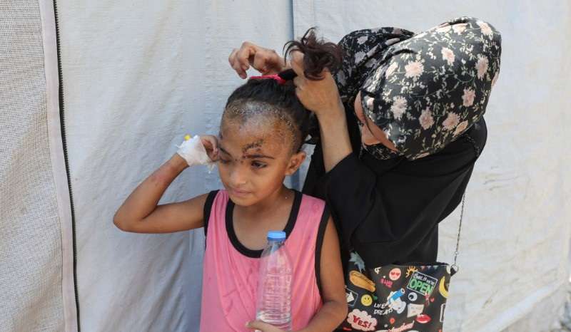 Gaza girl injured in her head in an Israeli strike battles hardship amid war