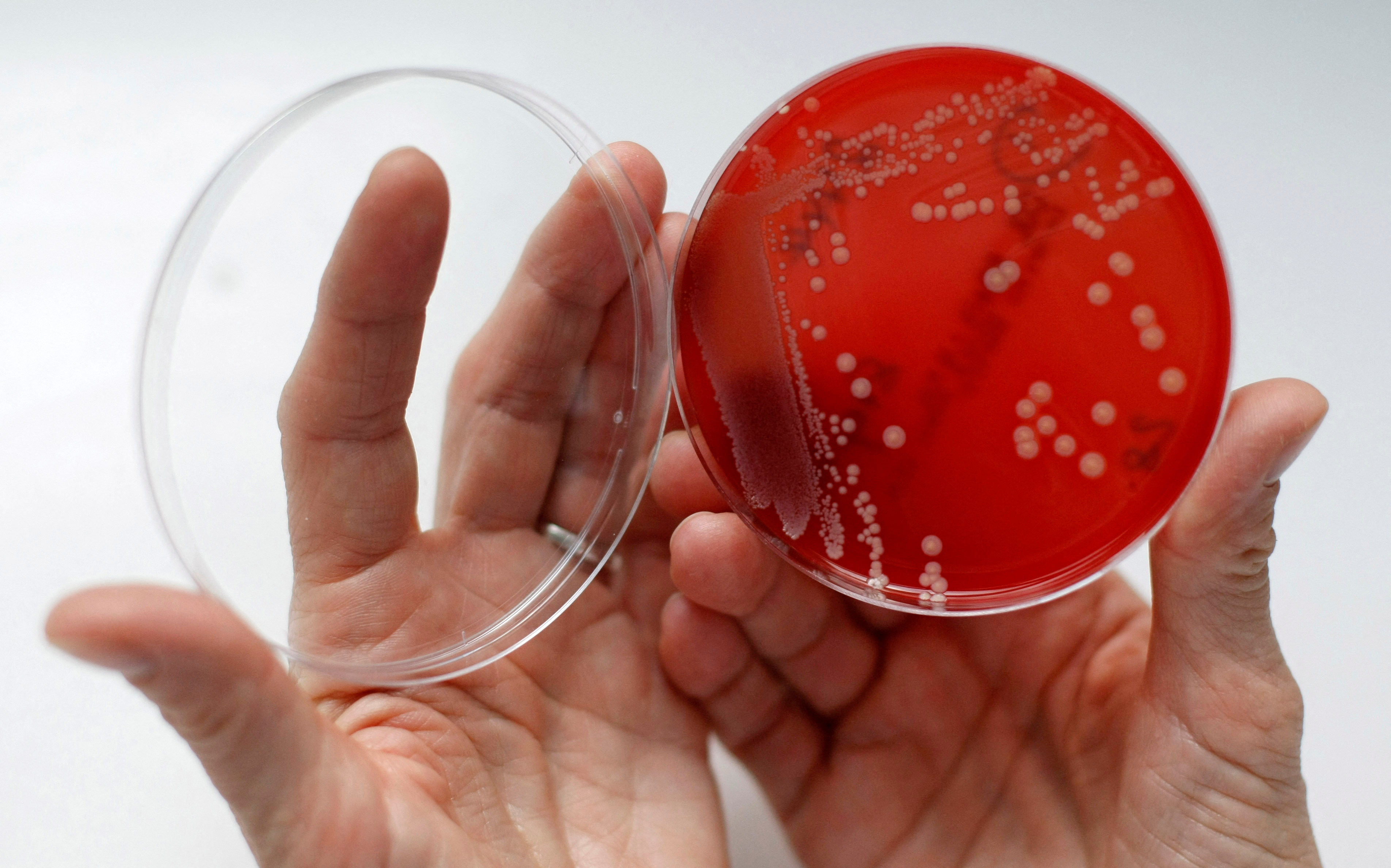 FILE PHOTO: An employee displays MRSA bacteria inside a petri dish in a microbiological laboratory in Berlin