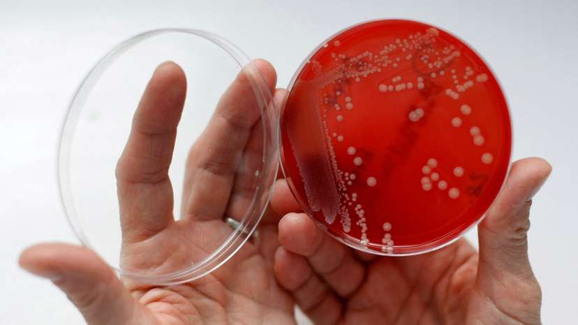 FILE PHOTO: An employee displays MRSA bacteria inside a petri dish in a microbiological laboratory in Berlin