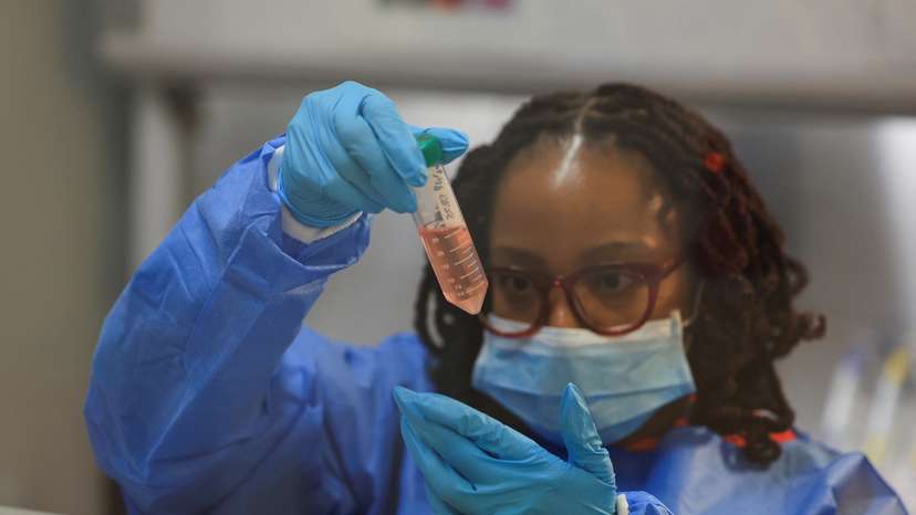 Trump's aid cuts stop HIV vaccine trials in their tracks