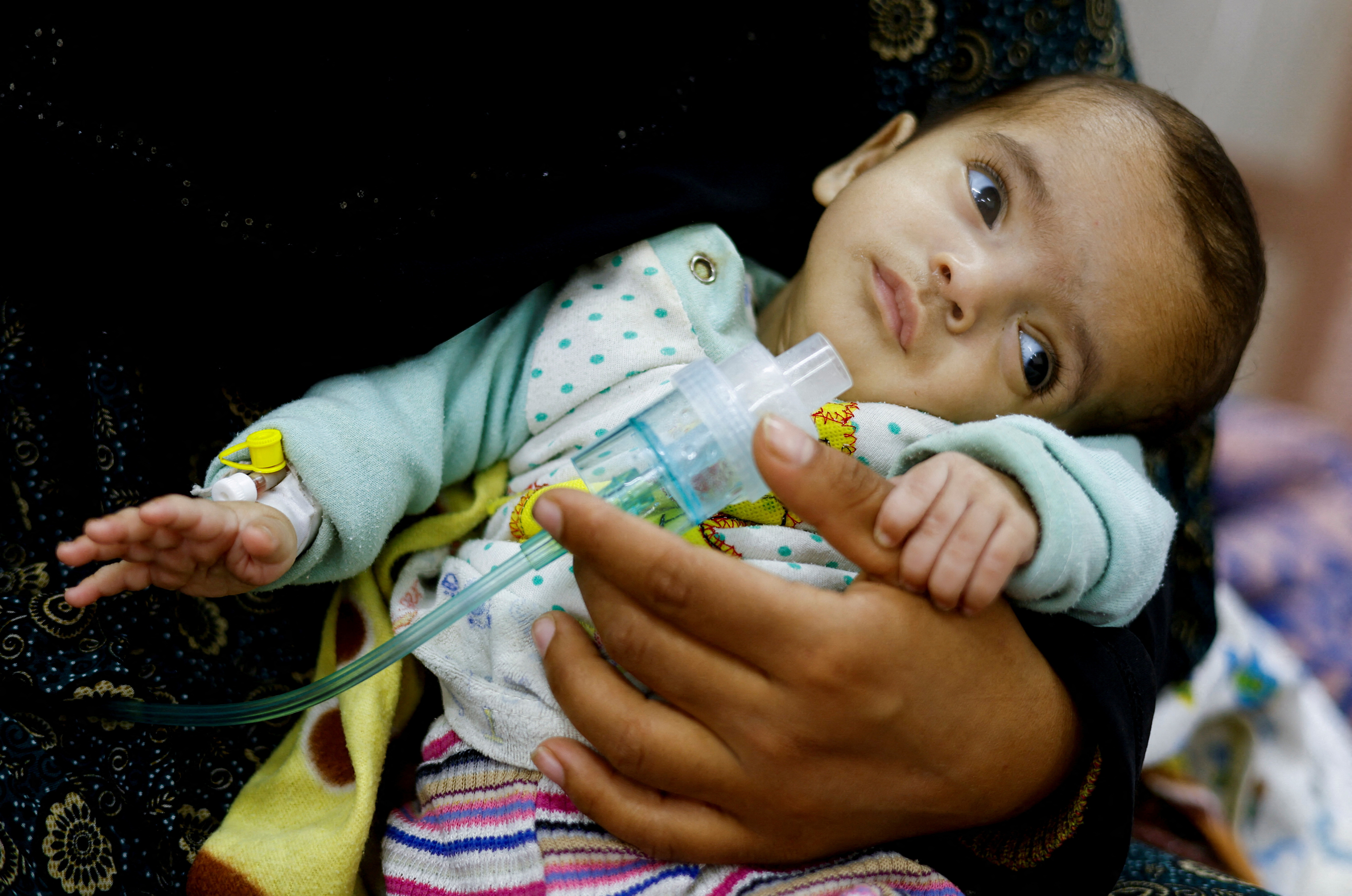 Palestinian woman Wafaa Tabasi holds her twin malnourished daughter Sameera, At al-Awda health centre in Rafah in the southern Gaza Strip