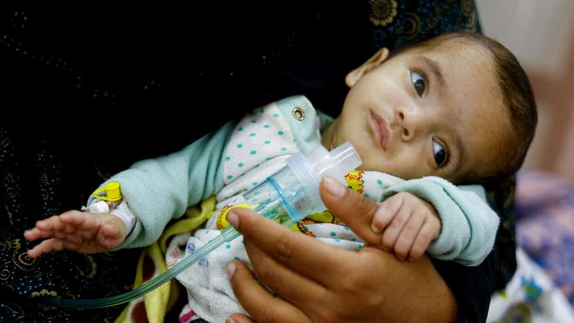 Palestinian woman Wafaa Tabasi holds her twin malnourished daughter Sameera, At al-Awda health centre in Rafah in the southern Gaza Strip