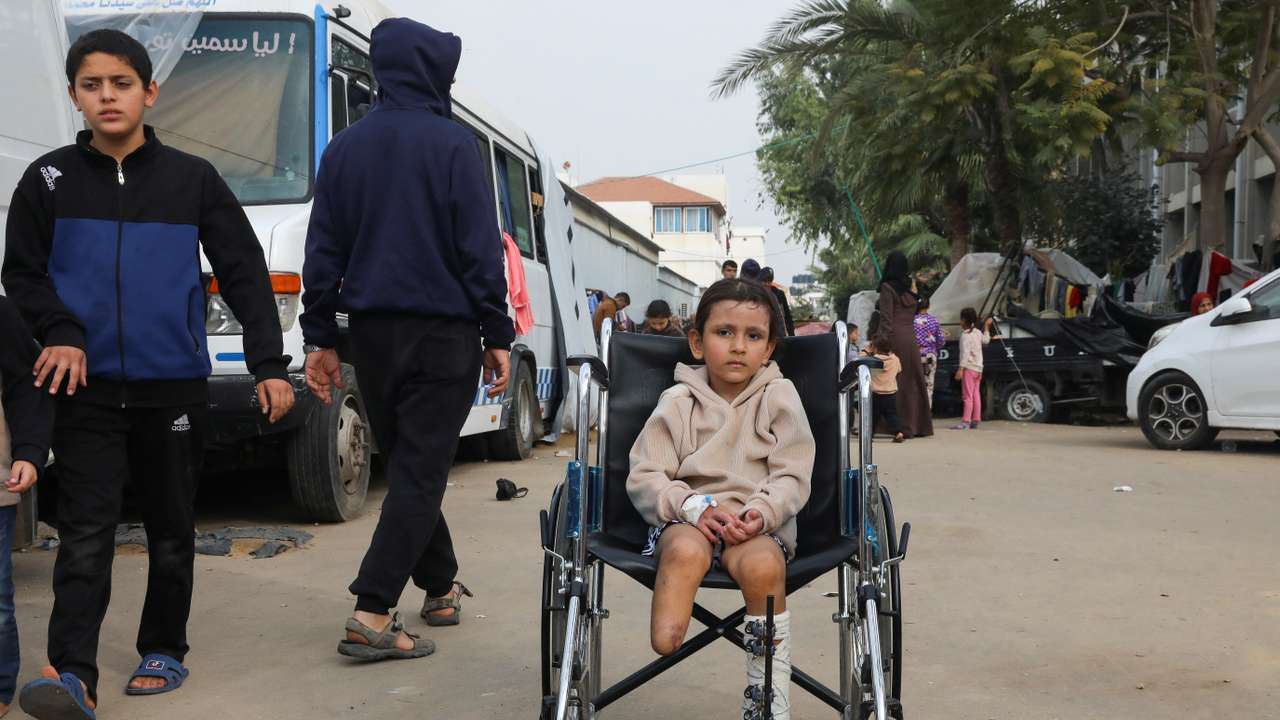 Surgeons report unprecedented numbers of limbs amputations among children in Gaza