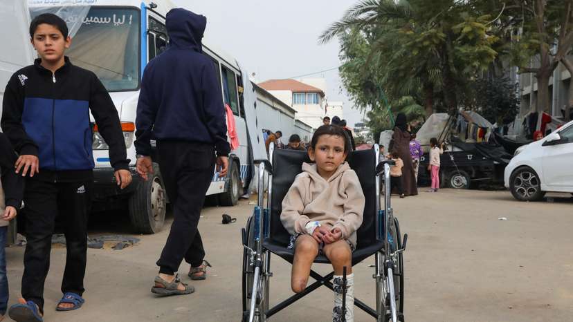 Surgeons report unprecedented numbers of limbs amputations among children in Gaza