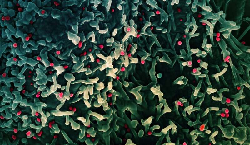 Colorized scanning electron micrograph of mpox virus captured at the NIAID Integrated Research Facility in Fort Detrick